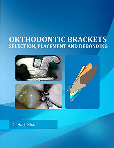 Orthodontic Brackets: Selection,Placement and Debonding by Dr Haris Khan, CreateSpace Independent Publishing Platform