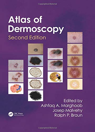 An Atlas of Dermoscopy by , CRC Press