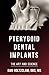 Pterygoid Implants by Dan Holtzclaw