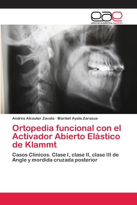 Ortopedia funcional con el Activador Abierto Elástico de Klammt: Casos Clínicos. Clase I, clase II, clase III de Angle y mordida cruzada posterior (Spanish Edition)