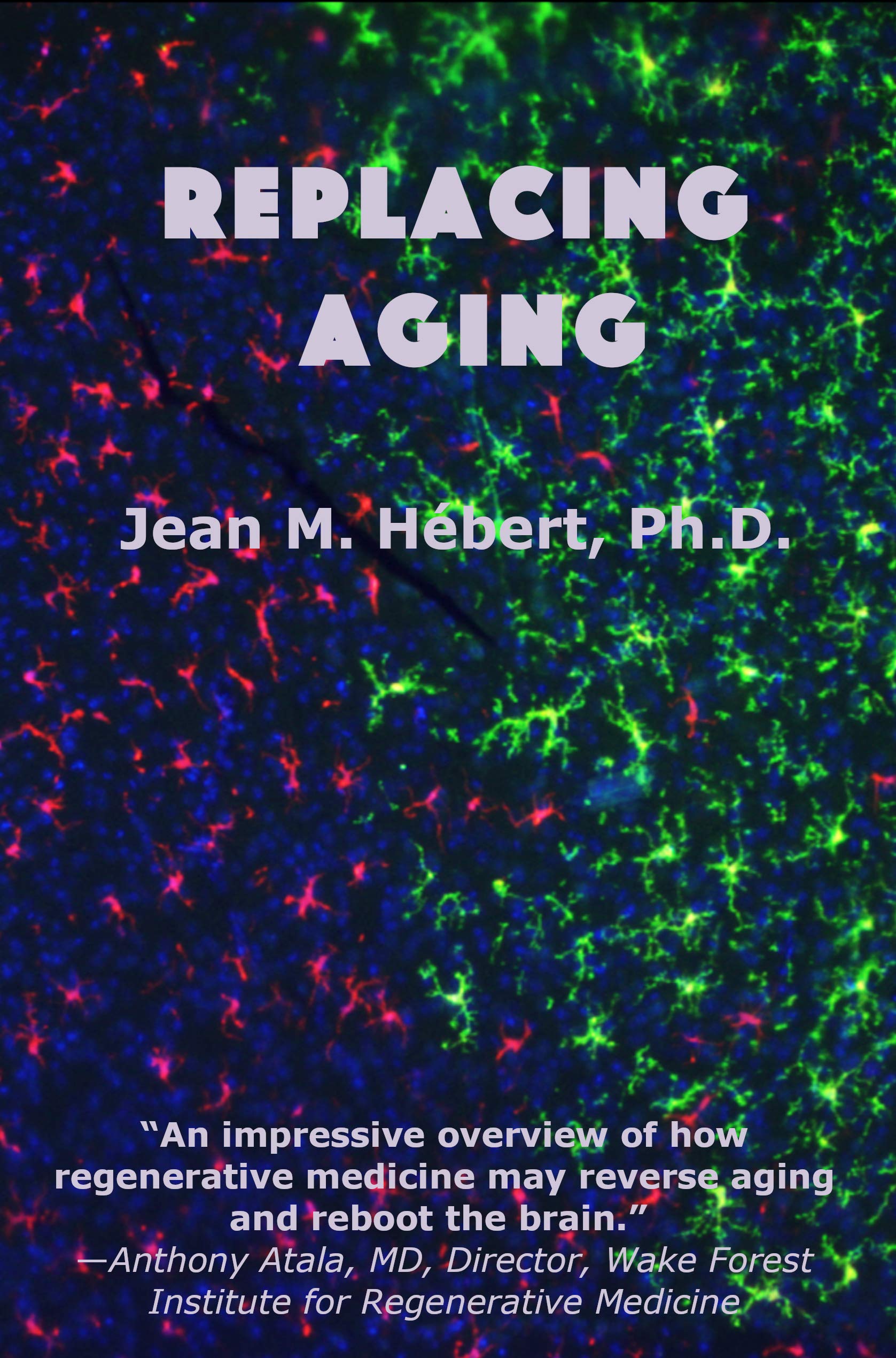 Replacing Aging (Kindle Edition)