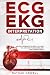 ECG/EKG Interpretation: An Easy Approach to Read a 12-Lead ECG and How to Diagnose and Treat Arrhythmias