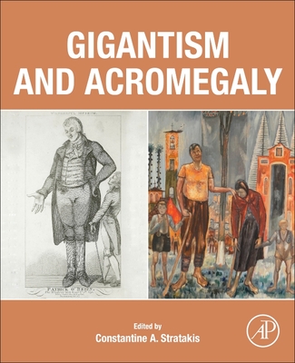Gigantism and Acromegaly: Genetics, Diagnosis, and Treatment (Paperback)