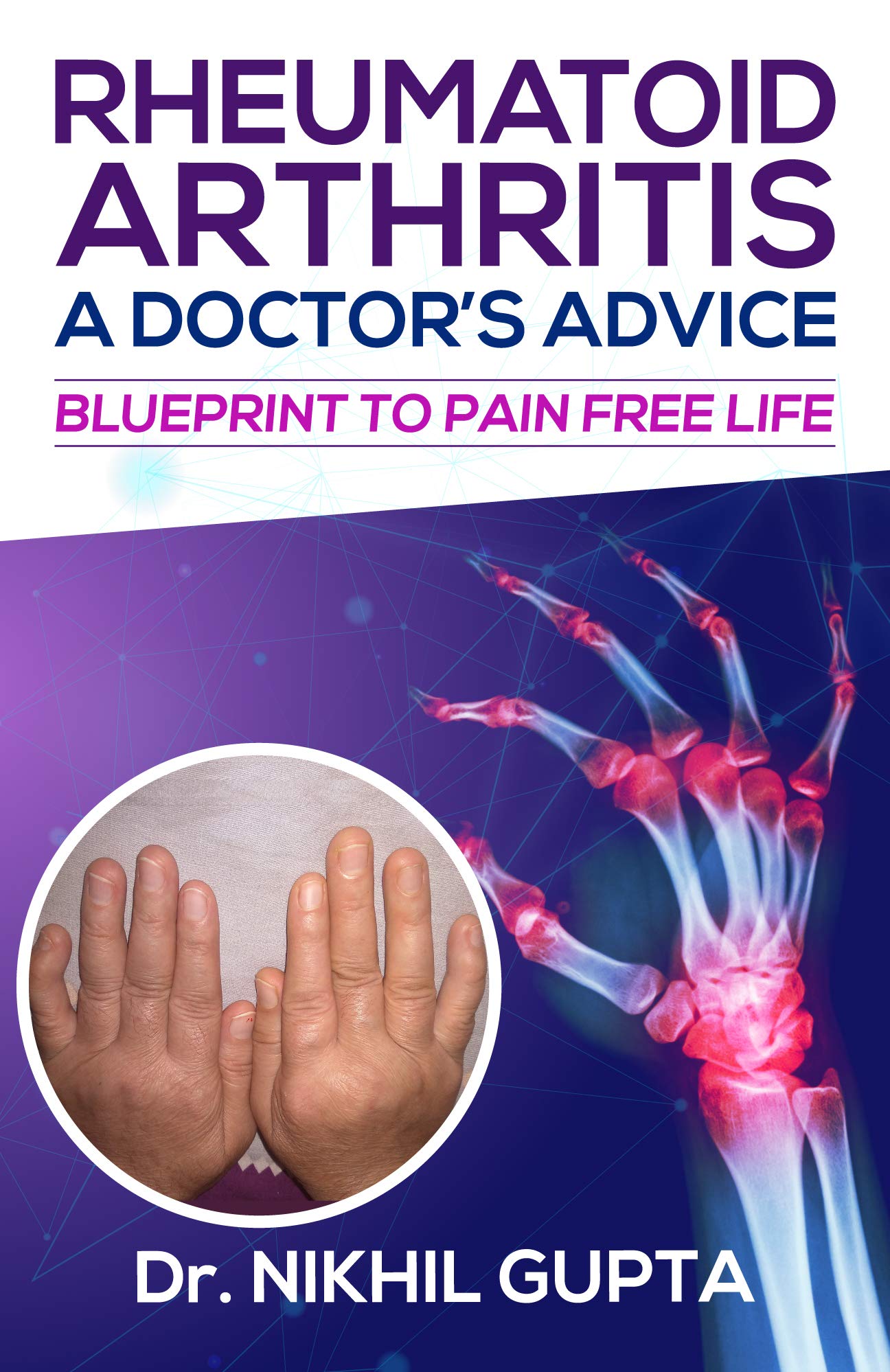 RHEUMATOID ARTHRITIS – A DOCTOR’s ADVICE : BLUEPRINT TO PAIN FREE LIFE (Kindle Edition)