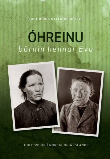Óhreinu börnin hennar Evu - Holdsveiki í Noregi og á Íslandi