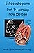 Echocardiograms - Part 1: Understanding the Basics.
