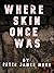 Where Skin Once Was