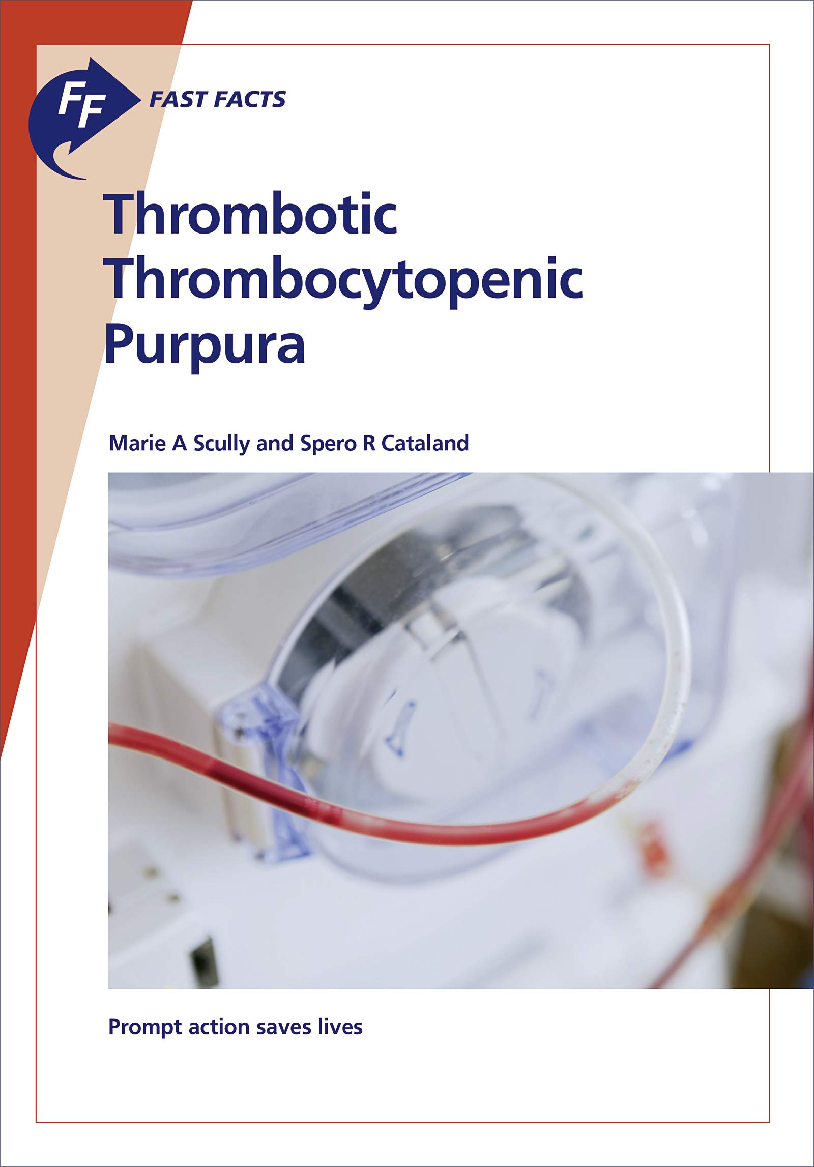 Fast Facts: Thrombotic Thrombocytopenic Purpura: Prompt Action Saves Lives (Kindle Edition)