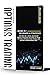 OPTIONS TRADING CRASH COURSE by Henry Living