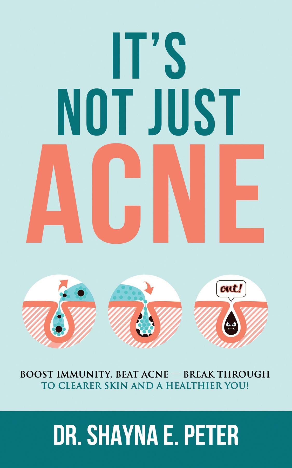 It's Not Just Acne: Boost Immunity, Beat Acne - Break Through to Clearer Skin & A Healthier You! (Kindle Edition)