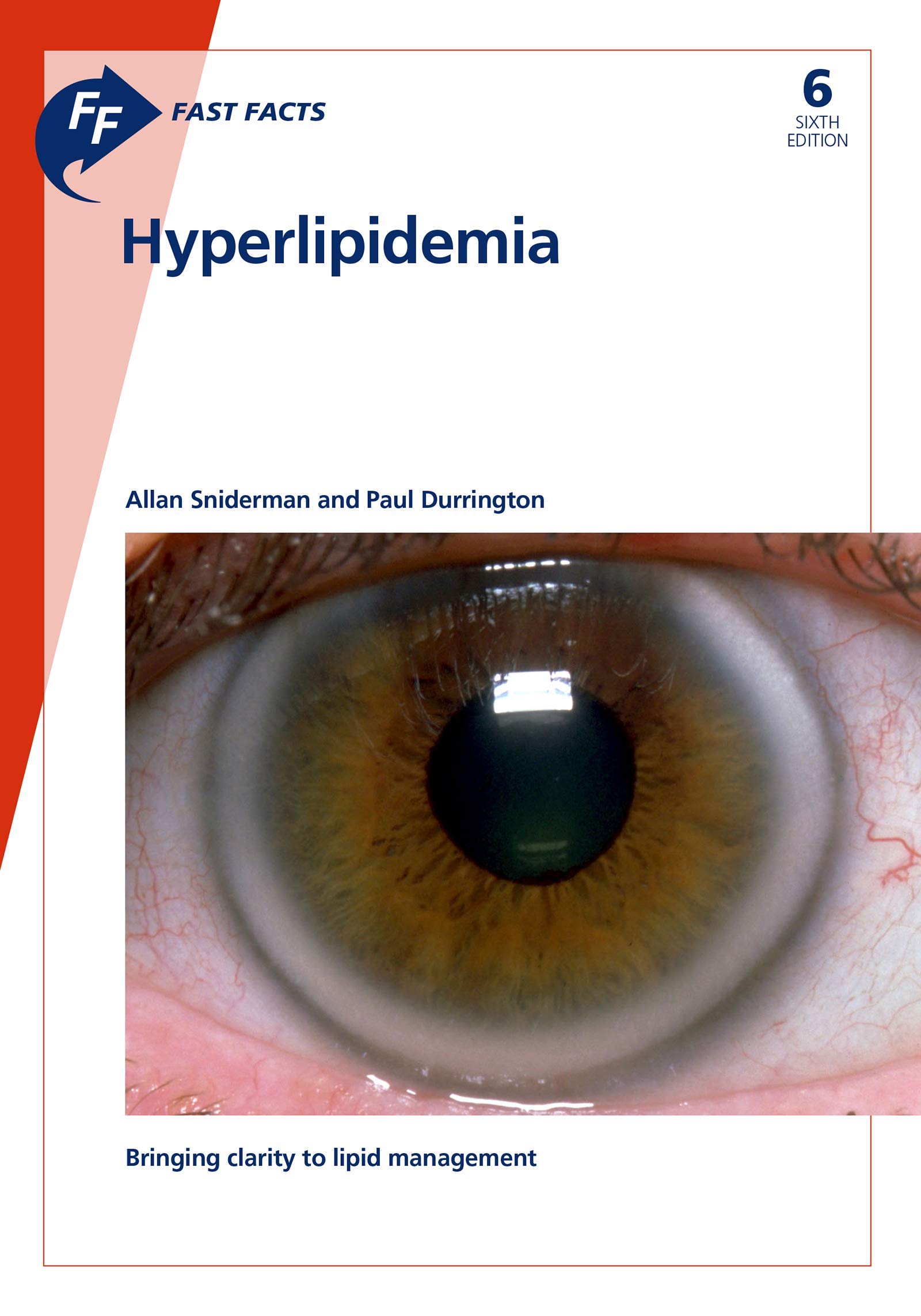 Fast Facts: Hyperlipidemia: Bringing Clarity to Lipid Management (Kindle Edition)