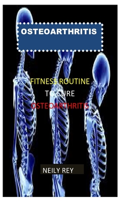 Osteoarthritis: Fitness Routines to Cure Osteoarthritis
