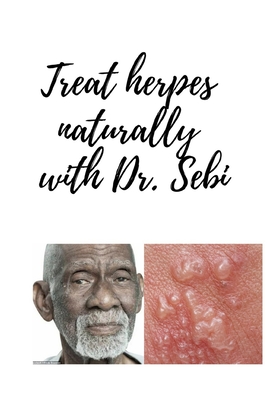 Treat herpes naturally with Dr. Sebi: Treat all types of herpes naturally and in the shortest time with Doctor SEBI