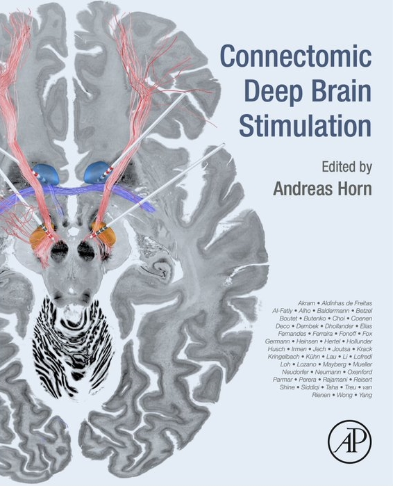 Connectomic Deep Brain Stimulation (Unknown Binding)