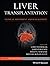 Liver Transplantation by James Neuberger