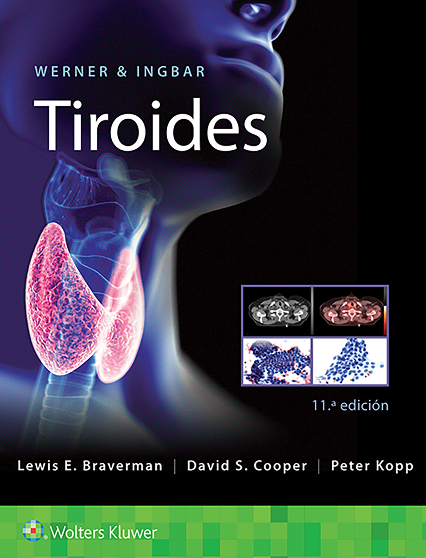 Werner & Ingbar. Tiroides (Spanish Edition)