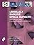 Minimally Invasive Spinal S...