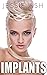 Implants