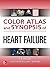Color Atlas and Synopsis of Heart Failure