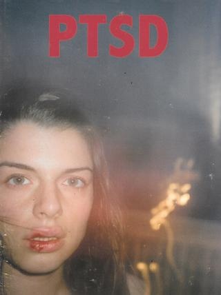 PTSD (Unknown Binding)