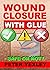 Using Super Glue on Wounds:...