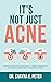 It's Not Just Acne: Boost Immunity, Fight Acne - Break Through to Clearer Skin & A Healthier You!