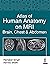 Atlas of Human Anatomy on MRI by Hariqbal Singh