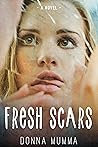 Fresh Scars: A Ta...