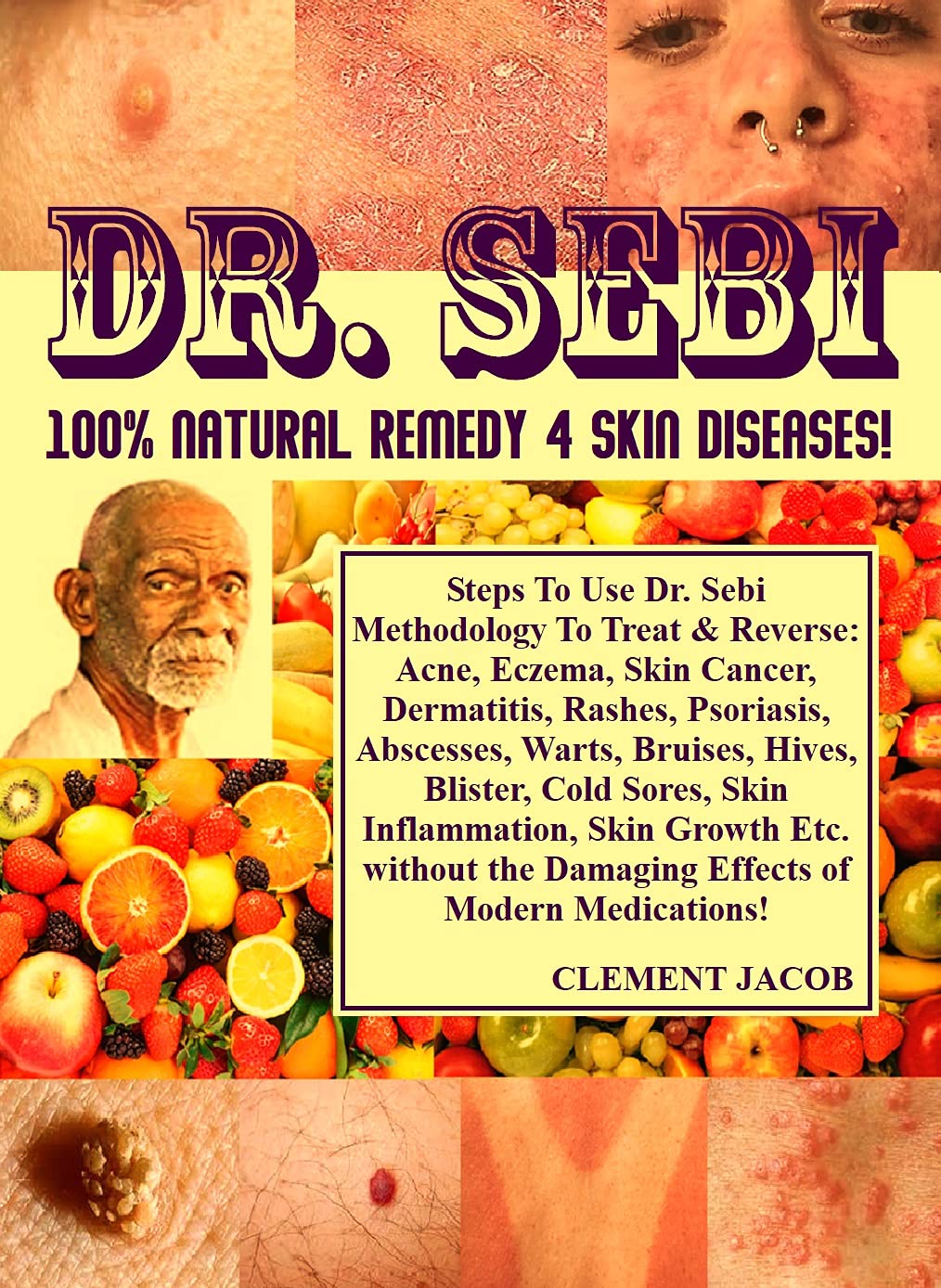 Dr. Sebi 100% Natural Remedy 4 Skin Diseases!: Steps To Use Dr. Sebi Methodology To Treat & Reverse: Acne, Eczema, Skin Cancer, Dermatitis, Rashes, Psoriasis, Abscesses, Warts, Bruises, Hives ... (Kindle Edition)