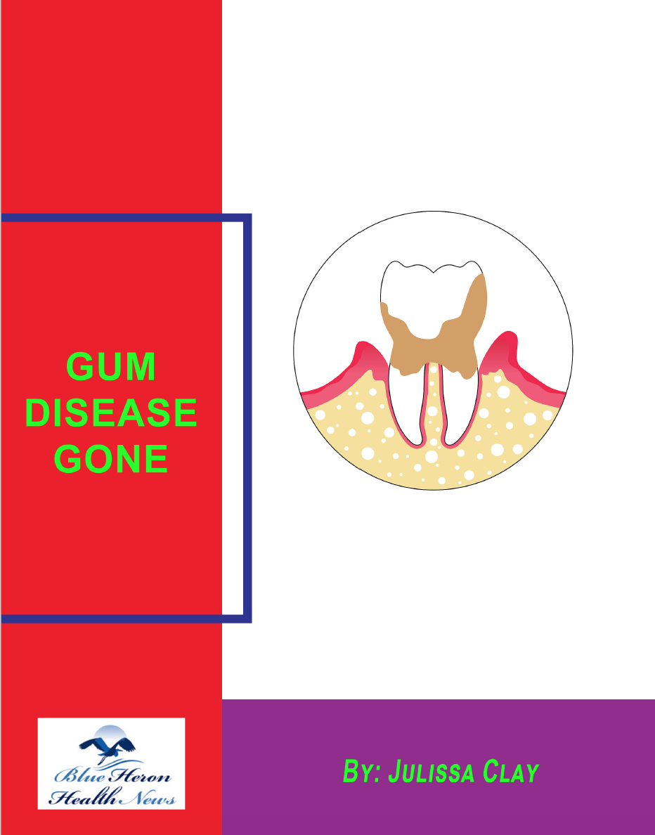 Gum Disease Gone