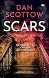 Scars