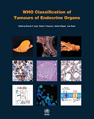 WHO Classification of Tumours of Endocrine Organs (Medicine) by International Agency for Research on Cancer, World Health Organization