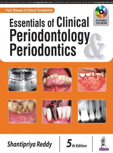 Essentials of Clinical Periodontology & Periodontics by Shantipriya Reddy, Jaypee Brothers Medical Publishers Pvt Ltd