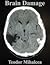 Brain Damage