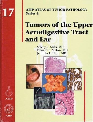 Tumors of the Upper Aerodigestive Tract and Ear (AFIP Atlas of Tumor Pathology, Fourth Series) by Stacey E., M.D. Mills, Amer Registry of Pathology