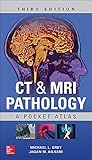 CT & MRI Pathology: A Pocket Atlas, Third Edition by Michael L Grey, McGraw-Hill Education / Medical