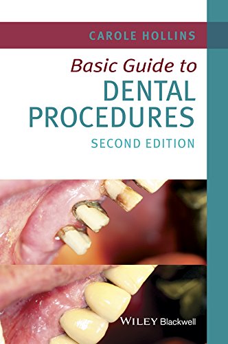 Basic Guide to Dental Procedures (Basic Guide Dentistry Series) by Carole Hollins, Wiley-Blackwell