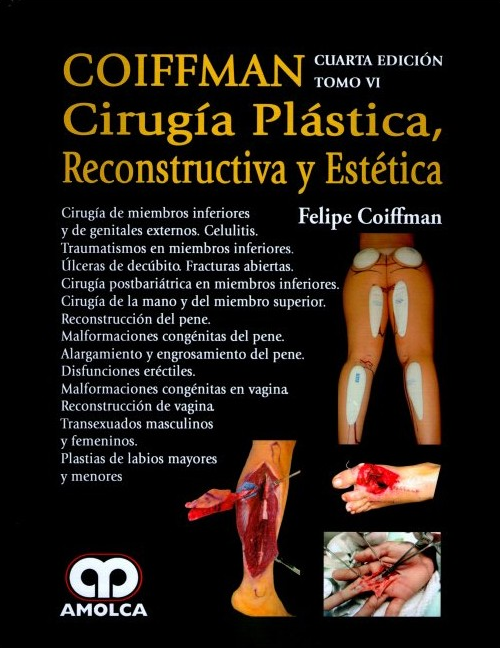 COIFFMAN VI: Cirugía de miembros inferiores y de genitales externos