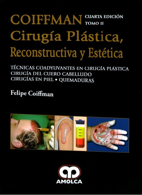 COIFFMAN II: Técnicas Coadyuvantes en Cirugía Plástica, Cirugía del Cuero Cabelludo, Cirugías en Piel, Quemaduras