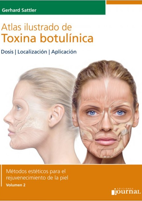 Atlas Ilustrado de Toxina Botulínica (Vol. 2)