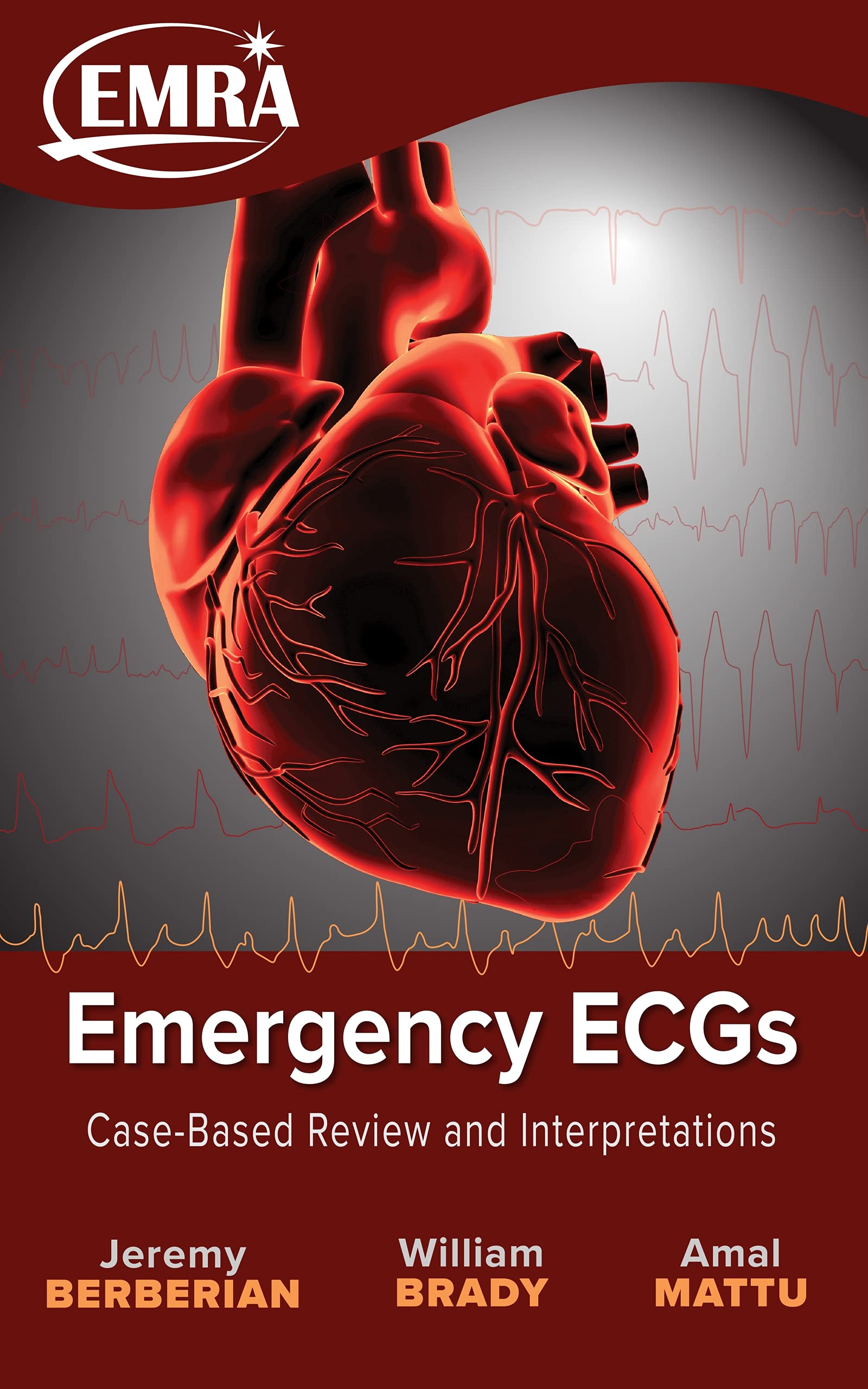 Emergency ECGs: Case-Based Review and Interpretations (Kindle Edition)
