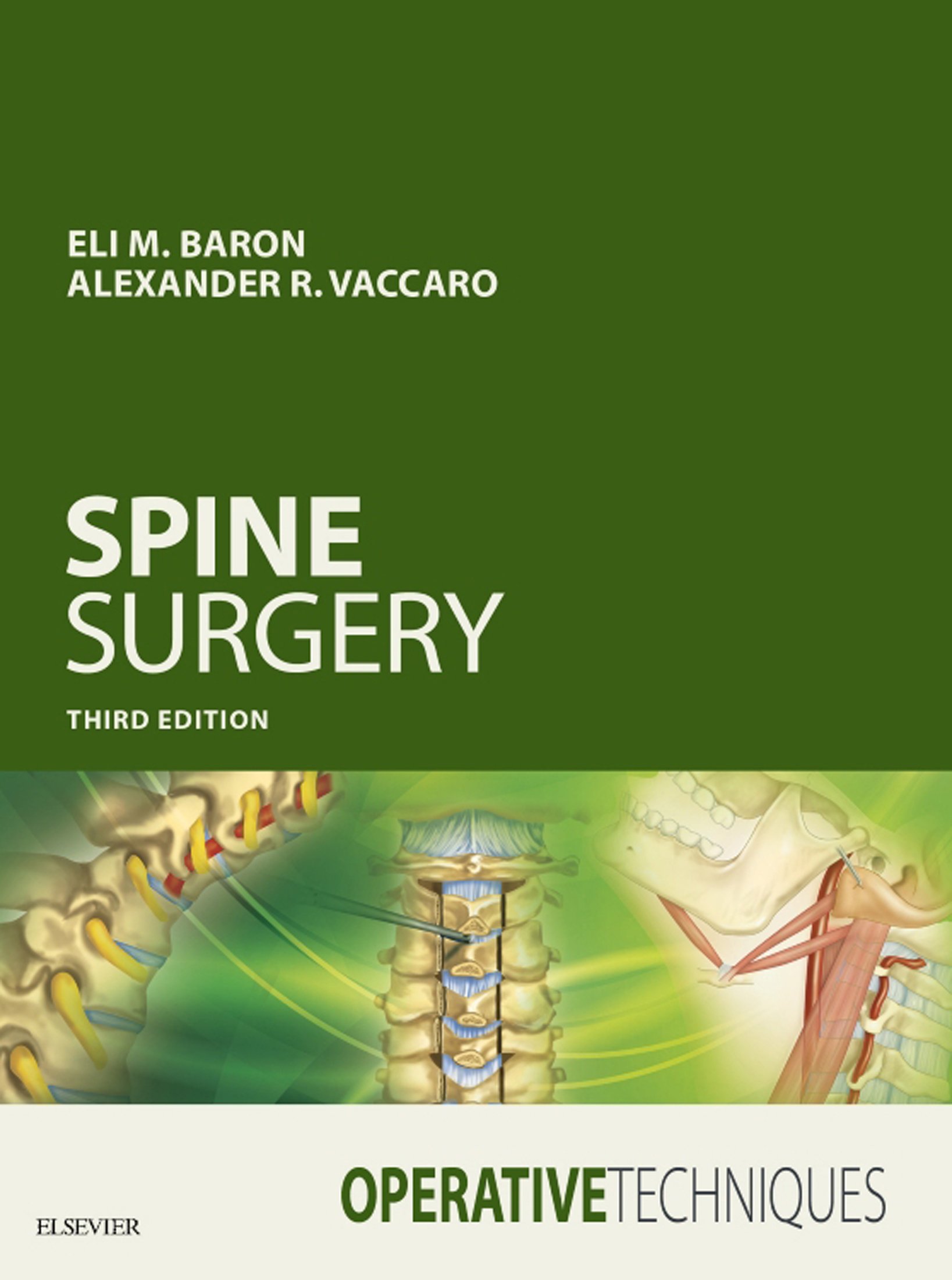 Operative techniques : spine surgery / [edited by] Alexander R Vaccaro, Eli M. Baron
