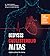 Didysis cholesterolio mitas: gydymo planas be statinų
