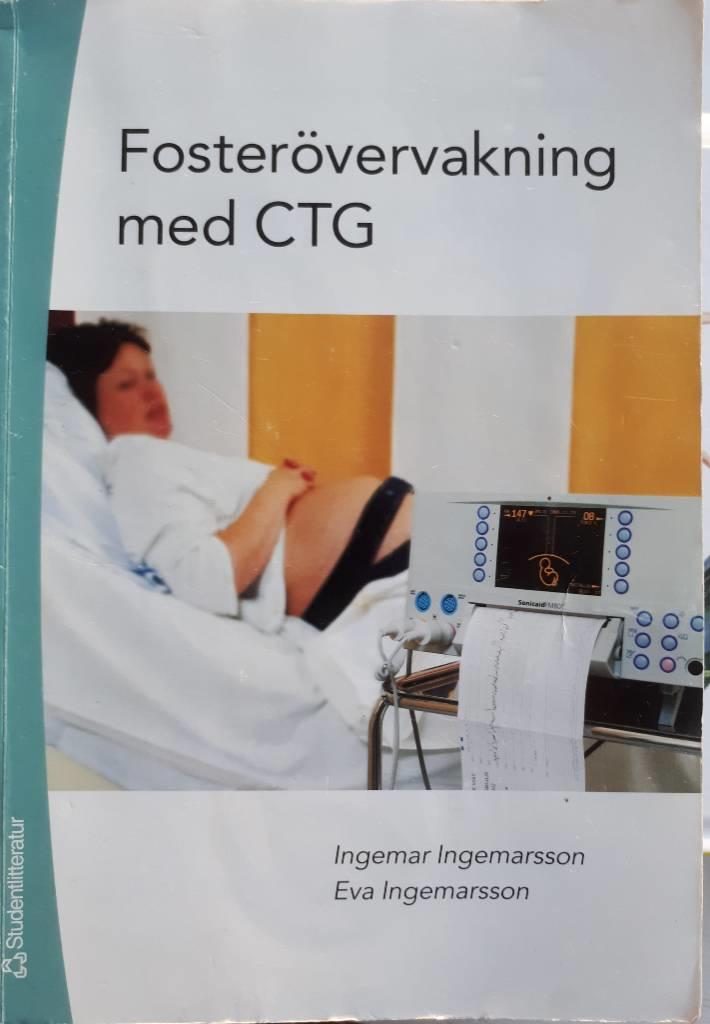 Fosterövervakning med CTG