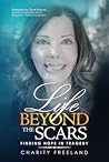Life Beyond the Scars: Finding Hope in Tragedy Life Beyond the Scars: Finding Hope in Tragedy