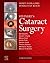 Cataract Surgery