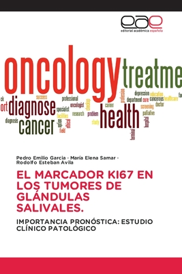 El Marcador Ki67 En Los Tumores de Glándulas Salivales. (Spanish Edition)