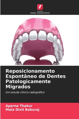 Reposicionamento Espontâneo de Dentes Patologicamente Migrados: Um estudo clínico-radiográfico (Portuguese Edition)