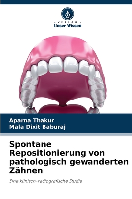 Spontane Repositionierung von pathologisch gewanderten Zähnen: Eine klinisch-radiografische Studie (German Edition)