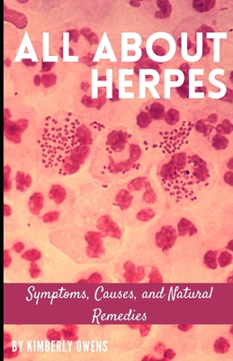 All about Herpes: Symptoms, Causes, and Natural Remedies